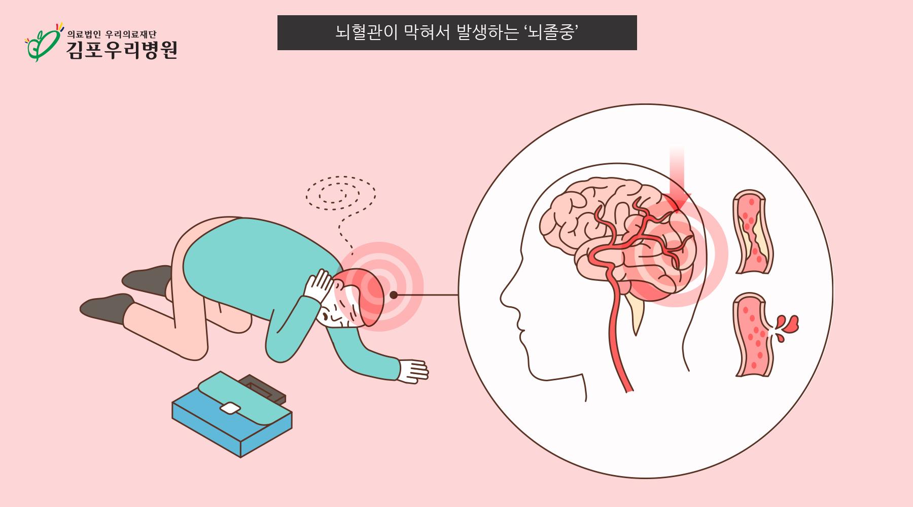 ‘혈관’이 막혀 발생하는 질환, 뇌졸중 알아보기!
