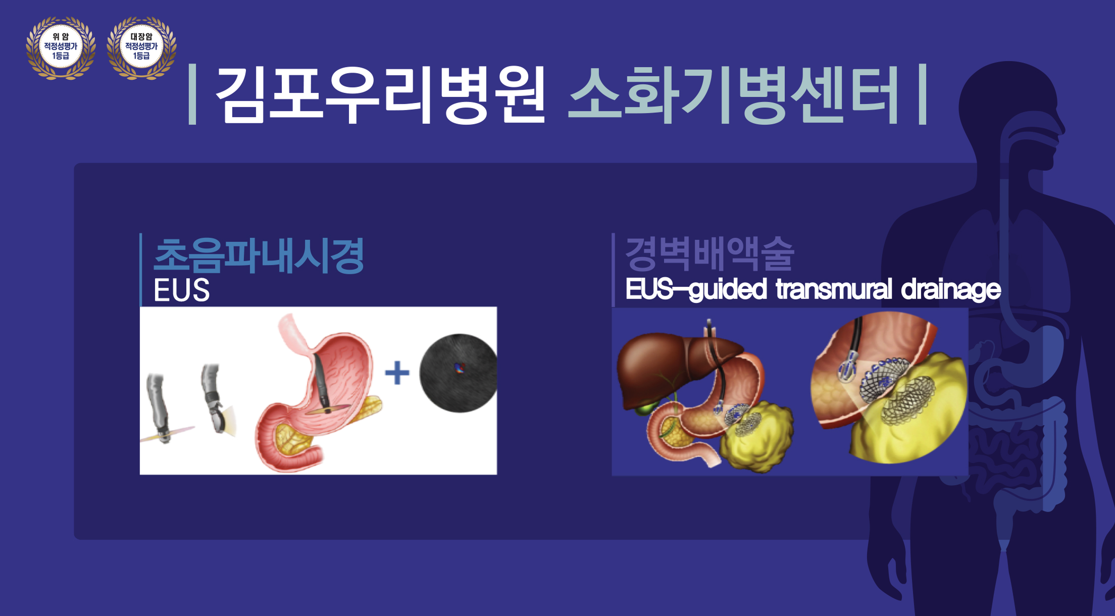 초음파내시경/경벽배액술 영상URL